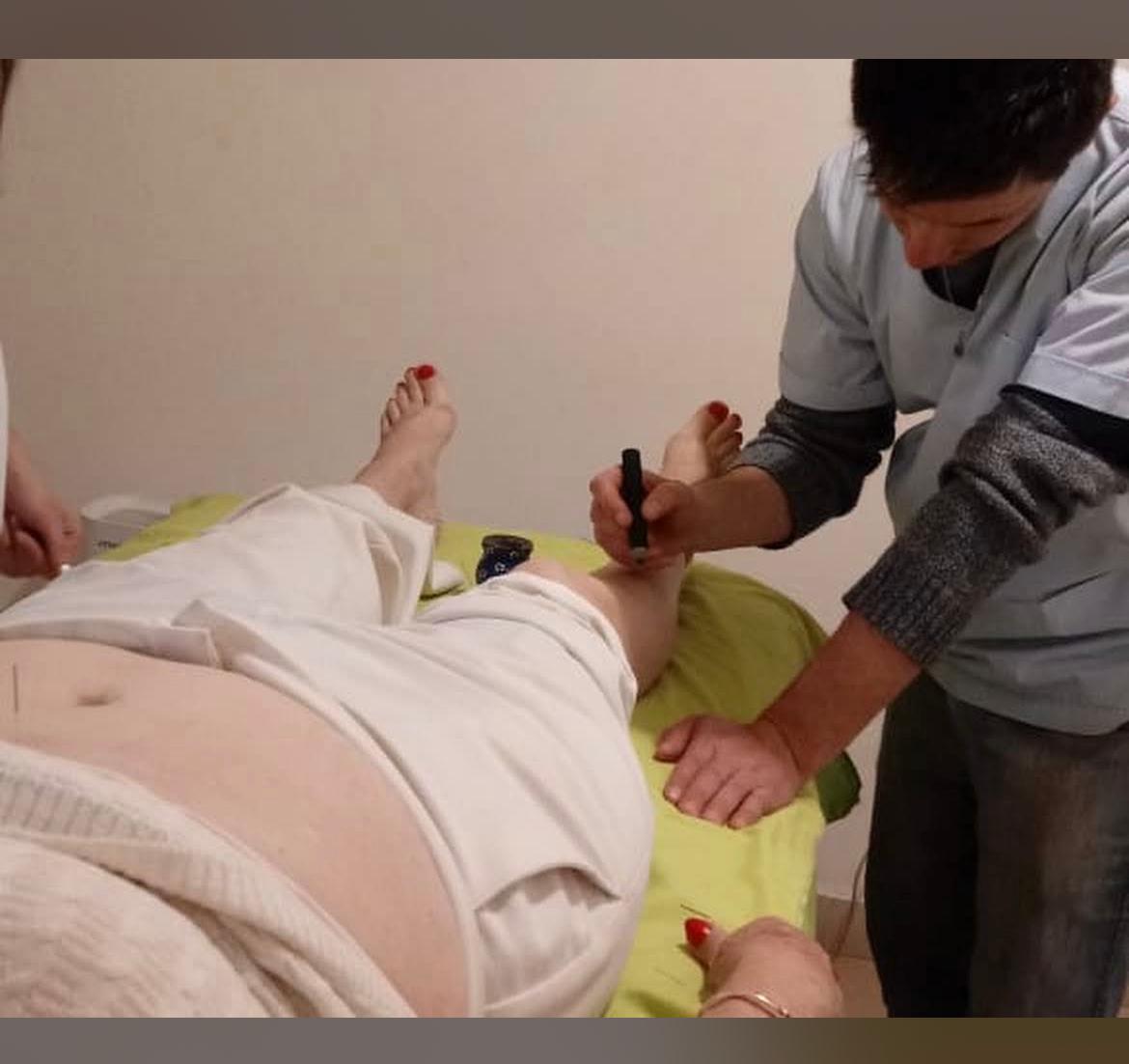 Moxibustion en tratamiento